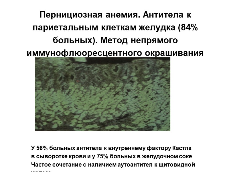 Пернициозная анемия. Антитела к париетальным клеткам желудка (84% больных). Метод непрямого иммунофлюоресцентного окрашивания 